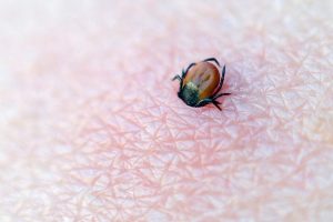 Lyme disease Treatment